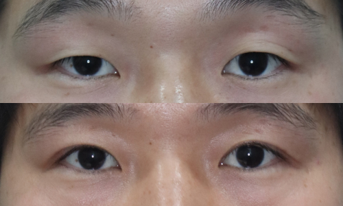 슬라이드30
